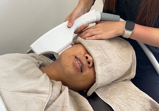 髭 DATSU Sauberの施術風景